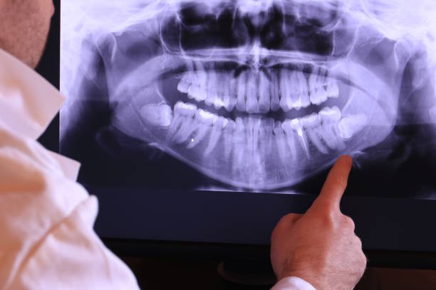 Best Emergency Treatment for Jaw Pain or Injury in Red Lodge, MT